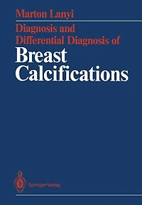 Diagnosis and Differential Diagnosis of Breast Calcifications