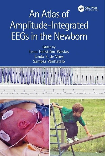 An Atlas of Amplitude-Integrated EEGs the Newborn
