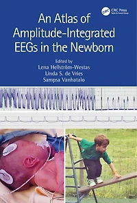 An Atlas of Amplitude-Integrated EEGs the Newborn