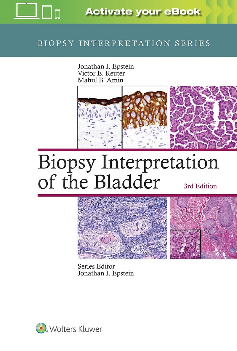 Biopsy Interpretation of the Bladder: Print + eBook with Multimedia