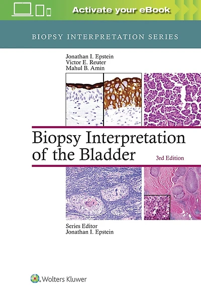 Biopsy Interpretation of the Bladder: Print + eBook with Multimedia