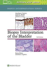 Biopsy Interpretation of the Bladder: Print + eBook with Multimedia