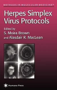Herpes Simplex Virus Protocols