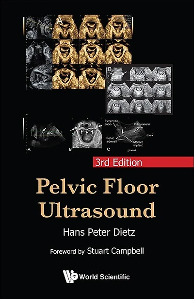 Pelvic Floor Ultrasound ()