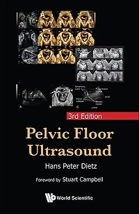 Pelvic Floor Ultrasound ()
