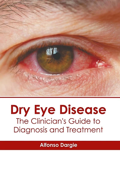 Dry Eye Disease: The Clinician's Guide to Diagnosis and Treatment