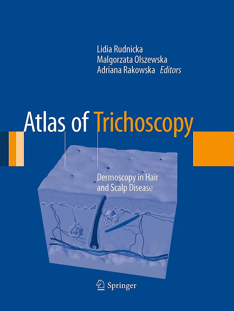 Atlas of Trichoscopy: Dermoscopy Hair and Scalp Disease