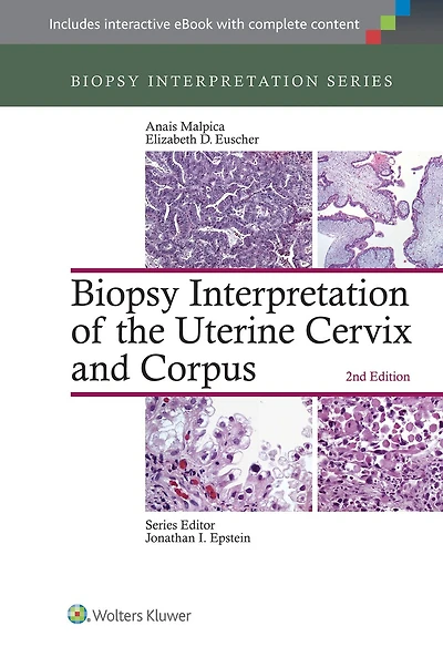 Biopsy Interpretation of the Uterine Cervix and Corpus: Print + eBook with Multimedia