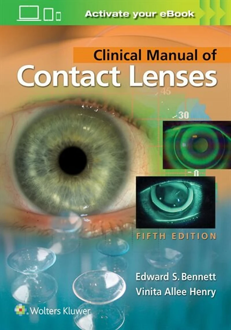 Clinical Manual Of Contact Lenses