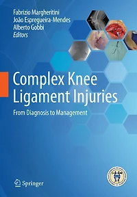 Complex Knee Ligament Injuries: From Diagnosis To Management
