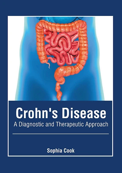 Crohn's Disease: A Diagnostic And Therapeutic Approach