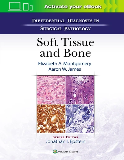 Differential Diagnoses Surgical Pathology: Soft Tissue And Bone