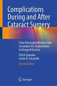 Complications During and After Cataract Surgery: A Guide to Surgical Management