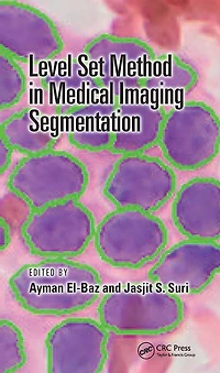 Level Set Method Medical Imaging Segmentation