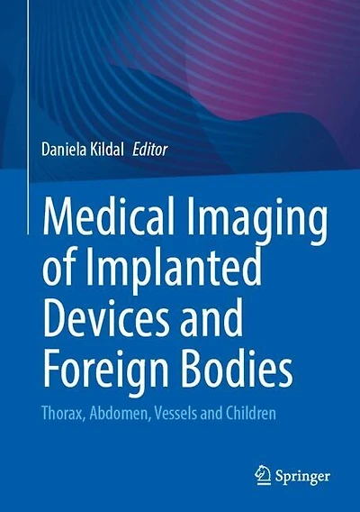 Medical Imaging of Implanted Devices and Foreign Bodies: Thorax, Abdomen, Vessels Children
