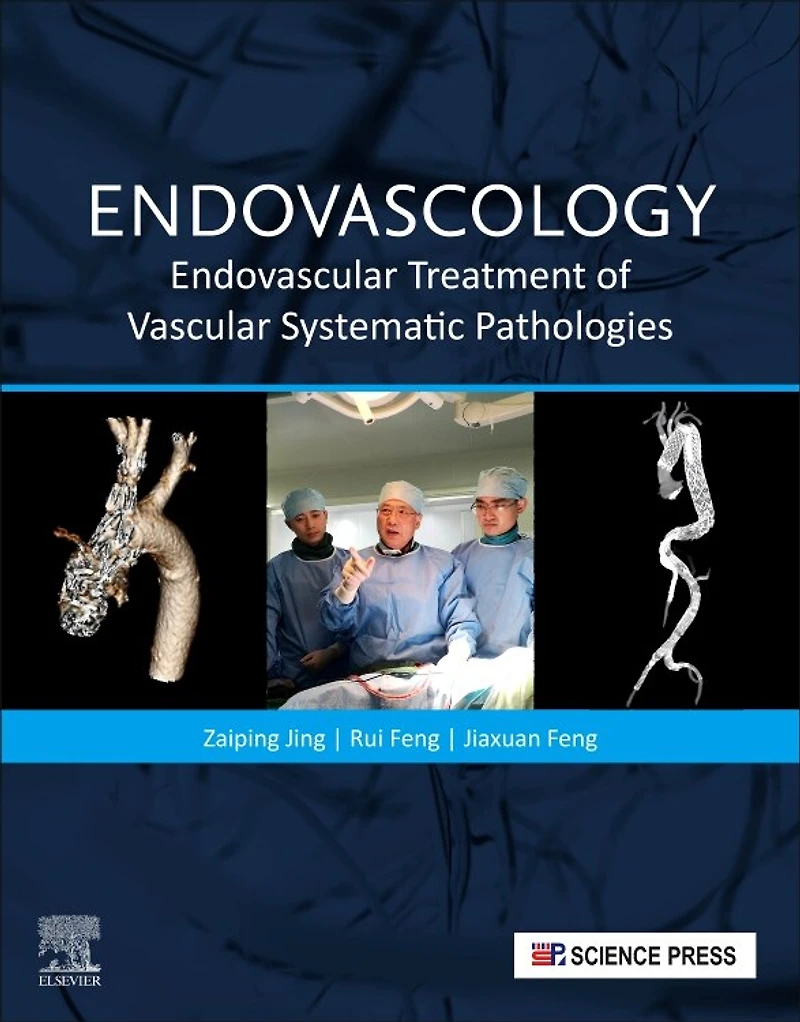 Endovascology: Endovascular Treatment Of Vascular Systematic Pathologies