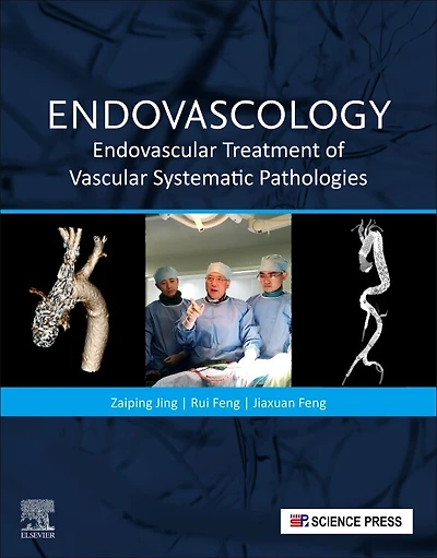 Endovascology: Endovascular Treatment Of Vascular Systematic Pathologies