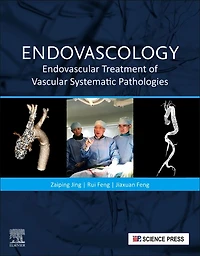 Endovascology: Endovascular Treatment Of Vascular Systematic Pathologies