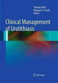 Clinical Management of Urolithiasis