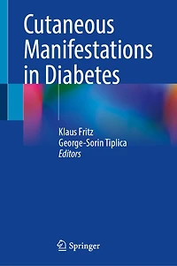 Cutaneous Manifestations Diabetes