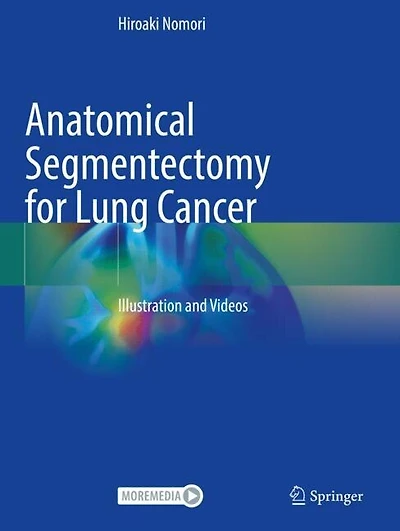Anatomical Segmentectomy for Lung Cancer: Illustration and Videos