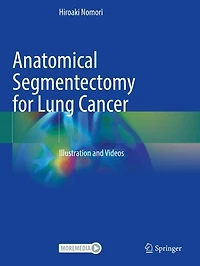 Anatomical Segmentectomy for Lung Cancer: Illustration and Videos