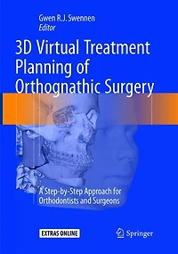 3D Virtual Treatment Planning of Orthognathic Surgery: A Step-by-Step Approach for Orthodontists and Surgeons