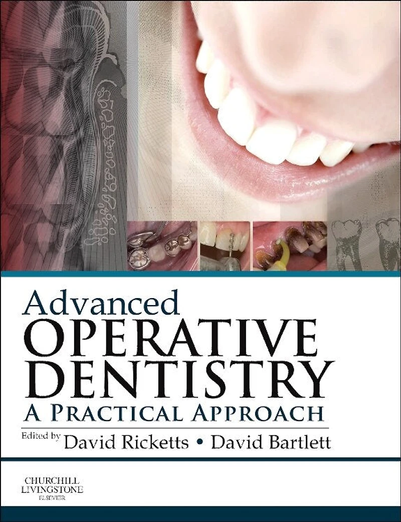 Advanced Operative Dentistry: A Practical Approach