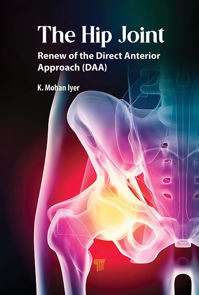 Hip Joint: Renew of the Direct Anterior Approach (DAA)