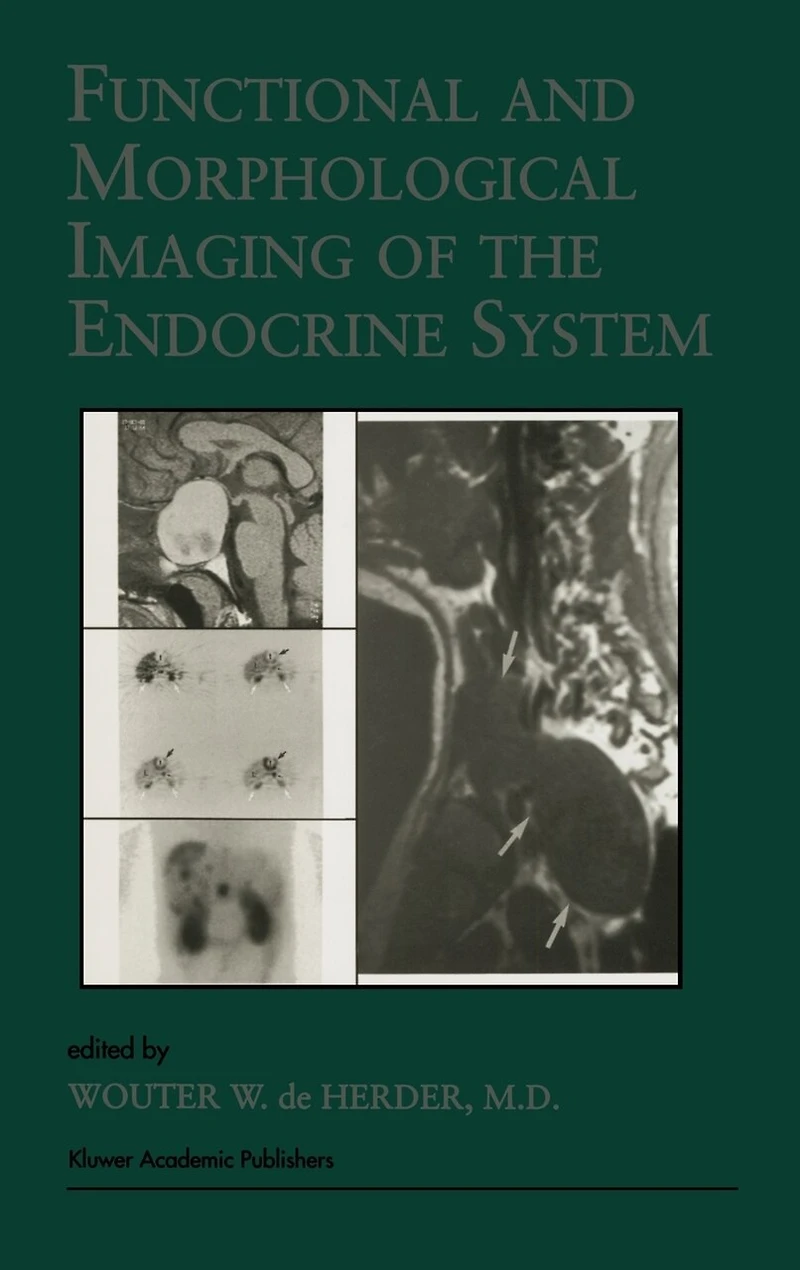 Functional and Morphological Imaging of the Endocrine System