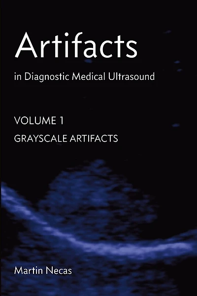 Artifacts in Diagnostic Medical Ultrasound: Grayscale Artifacts