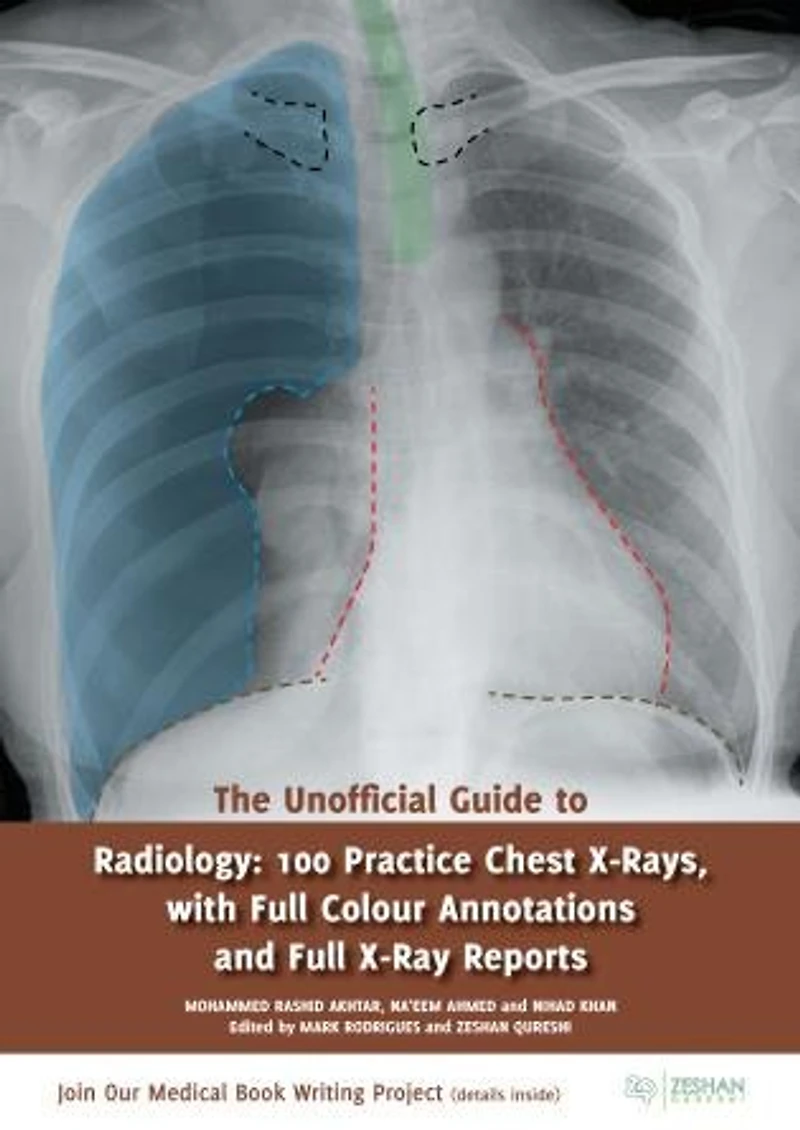 The Unofficial Guide to Radiology: 100 Practice Chest X-Rays