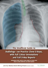 The Unofficial Guide to Radiology: 100 Practice Chest X-Rays
