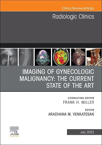 Imaging of Gynecologic Malignancy: the Current State Art, An Issue Radiologic Clinics North America