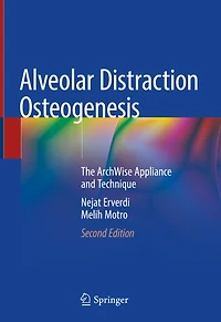 Alveolar Distraction Osteogenesis: The Archwise Appliance And Technique