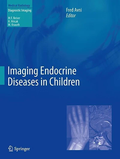 Imaging Endocrine Diseases Children