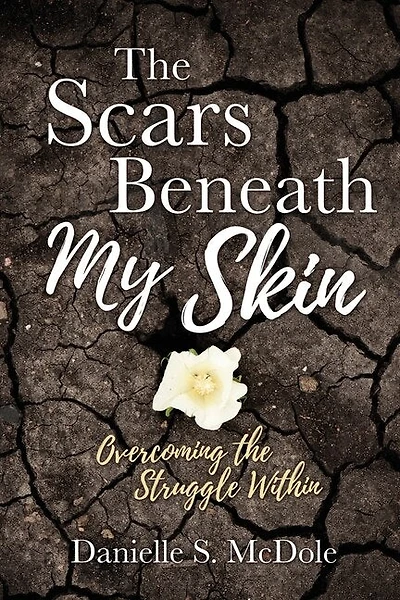 The Scars Beneath My Skin: Overcoming The Struggle Within