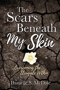 The Scars Beneath My Skin: Overcoming The Struggle Within