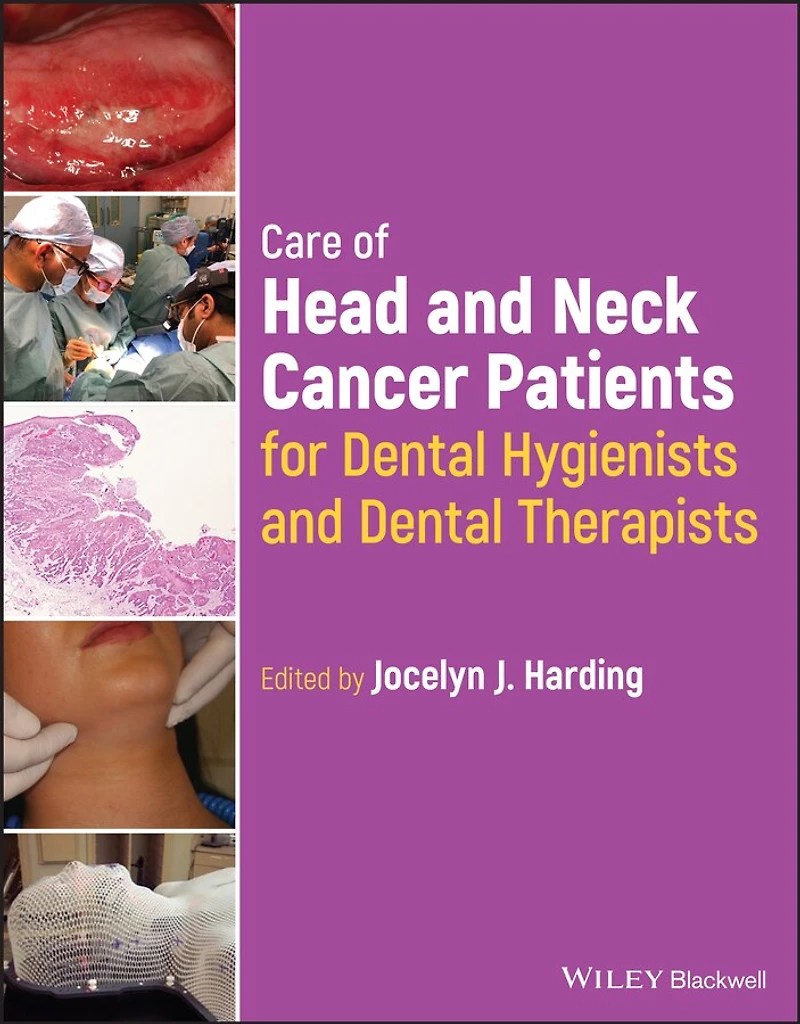 Care of Head and Neck Cancer Patients for Dental Hygienists Therapists
