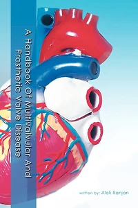 A Handbook Of Multivalvular And Prosthetic Valve Disease