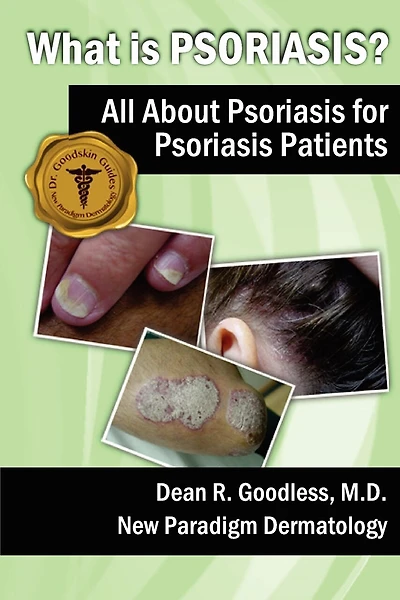 What is Psoriasis?: All About Psoriasis for Psoriasis Patients