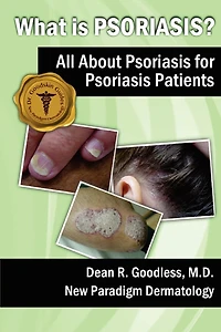 What is Psoriasis?: All About Psoriasis for Psoriasis Patients