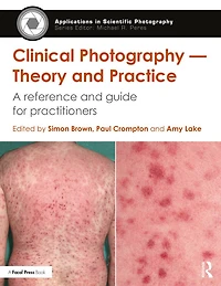 Clinical Photography - Theory and Practice: A Reference Guide for Practitioners