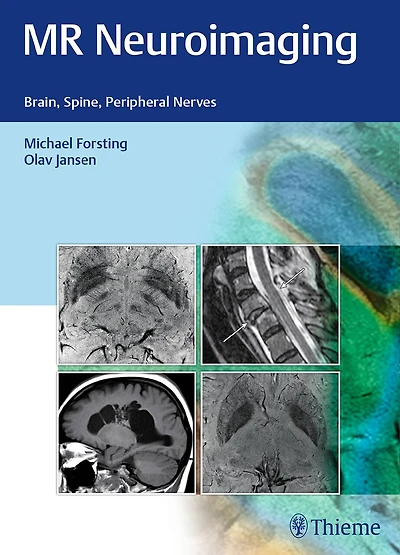 Mr Neuroimaging: Brain, Spine, Peripheral Nerves