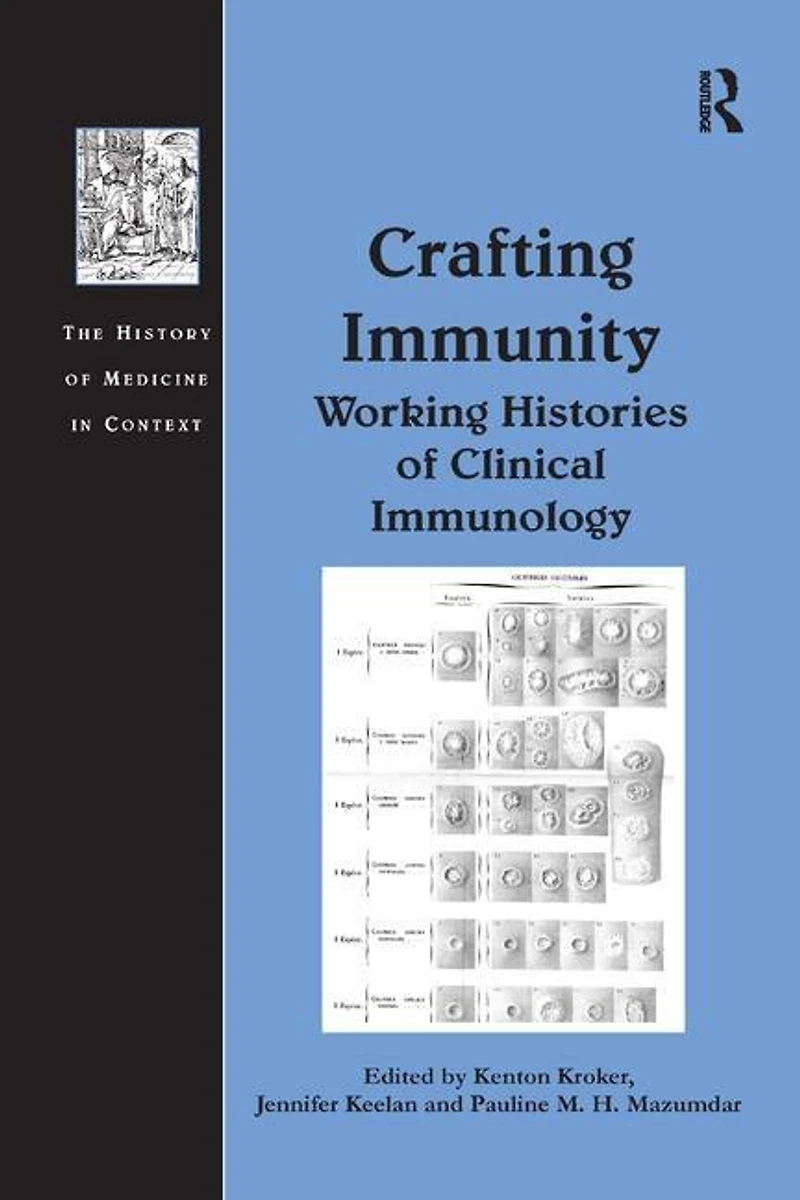 Crafting Immunity: Working Histories Of Clinical Immunology