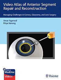 Video Atlas Of Anterior Segment Repair And Reconstruction: Managing Challenges Cornea, Glaucoma, Lens Surgery