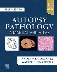 Autopsy Pathology: A Manual and Atlas