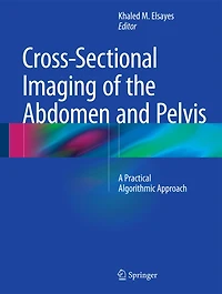Cross-sectional Imaging Of The Abdomen And Pelvis: A Practical Algorithmic Approach