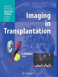 Imaging Transplantation