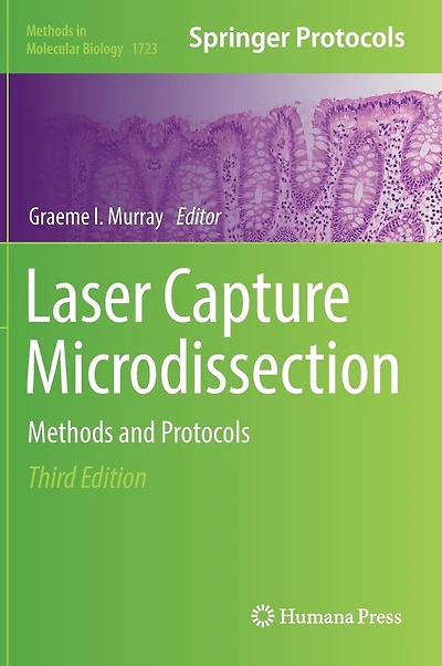 Laser Capture Microdissection: Methods And Protocols